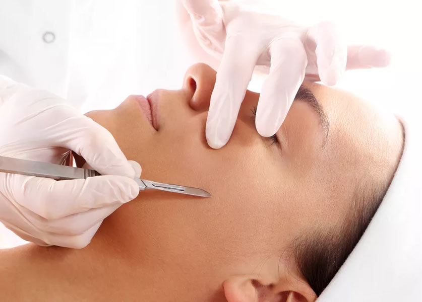 Dermaplaning : هل هذه التقنية لإزالة شعر الوجه فكرة جيدة؟