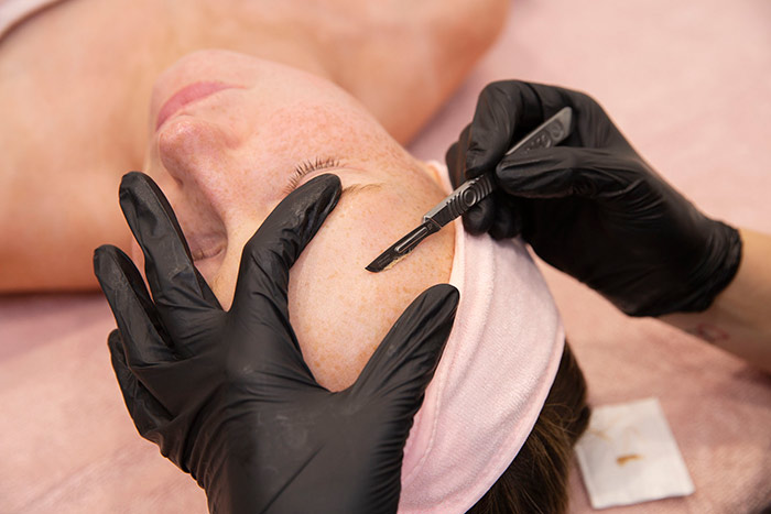 NRBeauty salon is your place to give Dermaplaning Facials