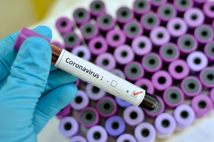 فيروس الكورونا: كل التدابير الوقائية لتجنّبه