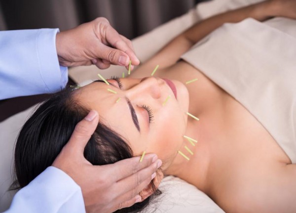 Everything to Know About The Acupuncture Facelift
