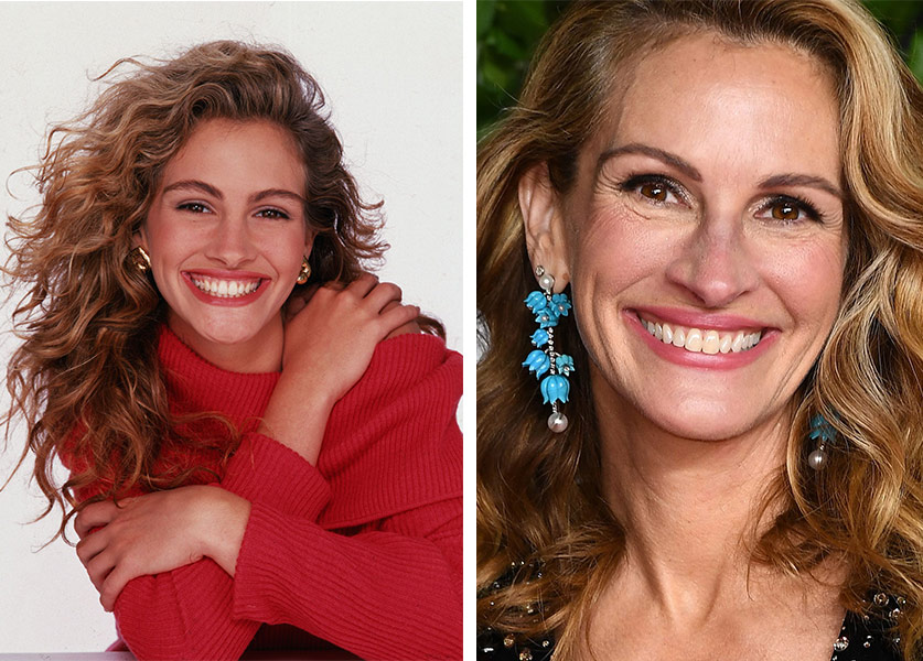 julia-roberts-before-and-after
