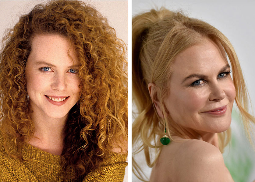 nicole-kidman-before-and-after