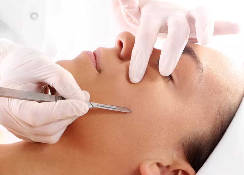 Dermaplaning, a Good Idea?