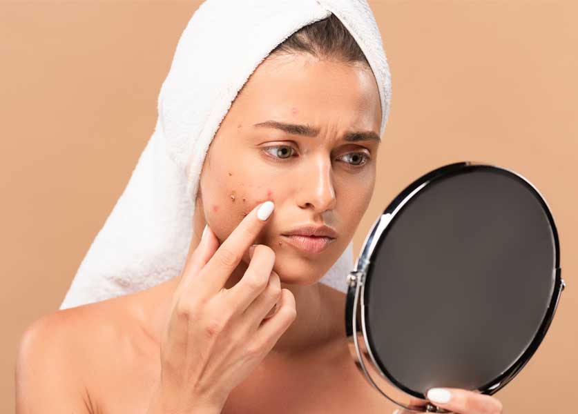 حيل بالمكياج لإخفاء الحبوب حيل بالمكياج لإخفاء الحبوب