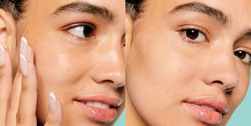 Unlock Radiant Skin with the Skin-Balancing Essence from Benefit