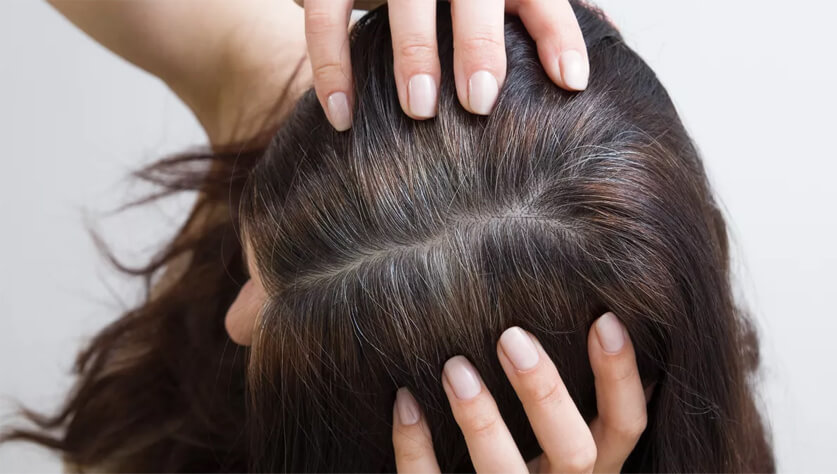 هل يمكن أن يصبح الشيب من الماضي؟